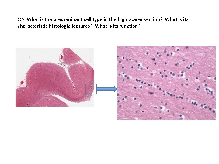 Q 5 What is the predominant cell type in the high power section? What