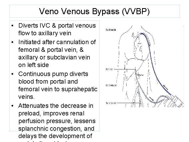 Venous Bypass (VVBP) • Diverts IVC & portal venous flow to axillary vein • Venous Bypass (VVBP) • Diverts IVC & portal venous flow to axillary vein •