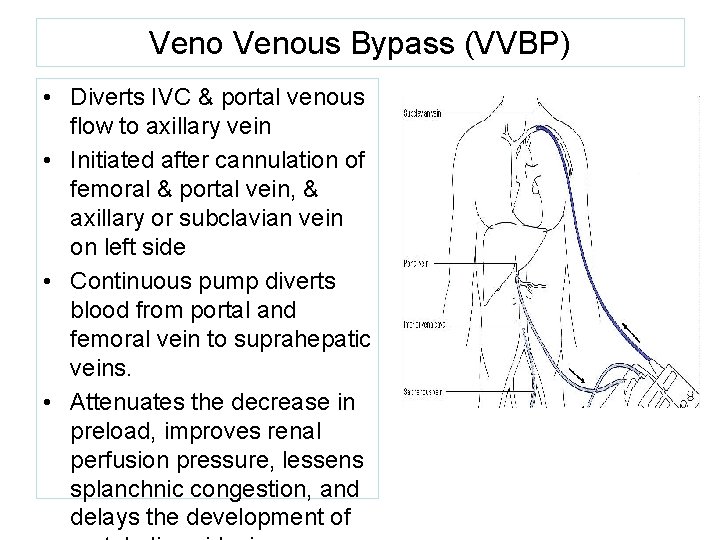 Venous Bypass (VVBP) • Diverts IVC & portal venous flow to axillary vein •