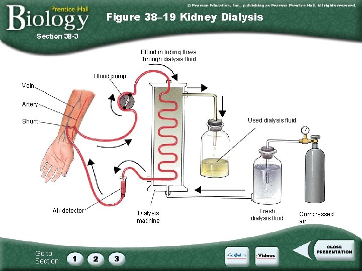 Figure 38– 19 Kidney Dialysis Section 38 -3 Blood in tubing flows through dialysis
