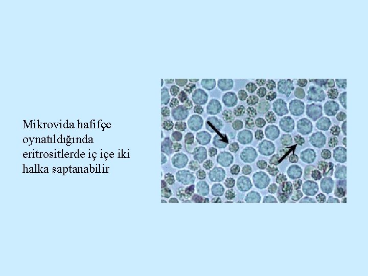 Mikrovida hafifçe oynatıldığında eritrositlerde iç içe iki halka saptanabilir 