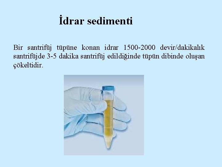 İdrar sedimenti Bir santrifüj tüpüne konan idrar 1500 -2000 devir/dakikalık santrifüjde 3 -5 dakika
