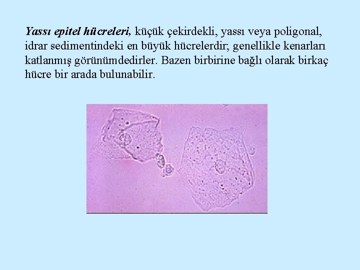 Yassı epitel hücreleri, küçük çekirdekli, yassı veya poligonal, idrar sedimentindeki en büyük hücrelerdir; genellikle