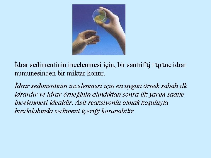 İdrar sedimentinin incelenmesi için, bir santrifüj tüpüne idrar numunesinden bir miktar konur. İdrar sedimentinin
