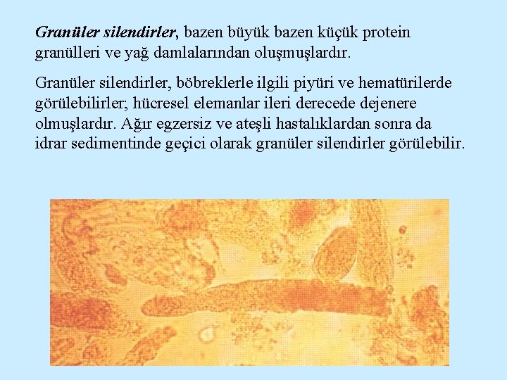 Granüler silendirler, bazen büyük bazen küçük protein granülleri ve yağ damlalarından oluşmuşlardır. Granüler silendirler,