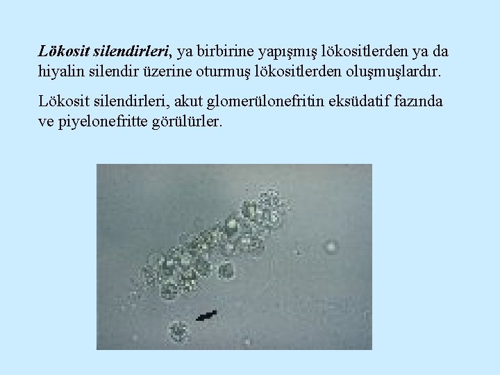 Lökosit silendirleri, ya birbirine yapışmış lökositlerden ya da hiyalin silendir üzerine oturmuş lökositlerden oluşmuşlardır.