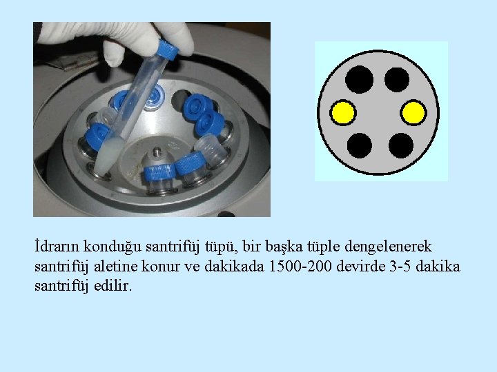 İdrarın konduğu santrifüj tüpü, bir başka tüple dengelenerek santrifüj aletine konur ve dakikada 1500