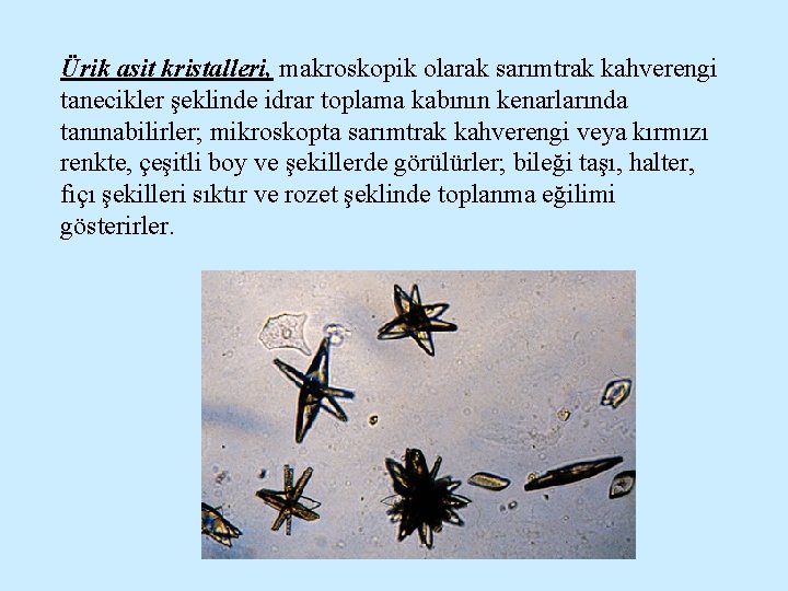 Ürik asit kristalleri, makroskopik olarak sarımtrak kahverengi tanecikler şeklinde idrar toplama kabının kenarlarında tanınabilirler;