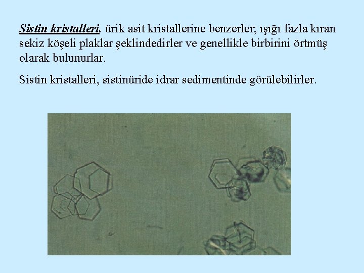 Sistin kristalleri, ürik asit kristallerine benzerler; ışığı fazla kıran sekiz köşeli plaklar şeklindedirler ve