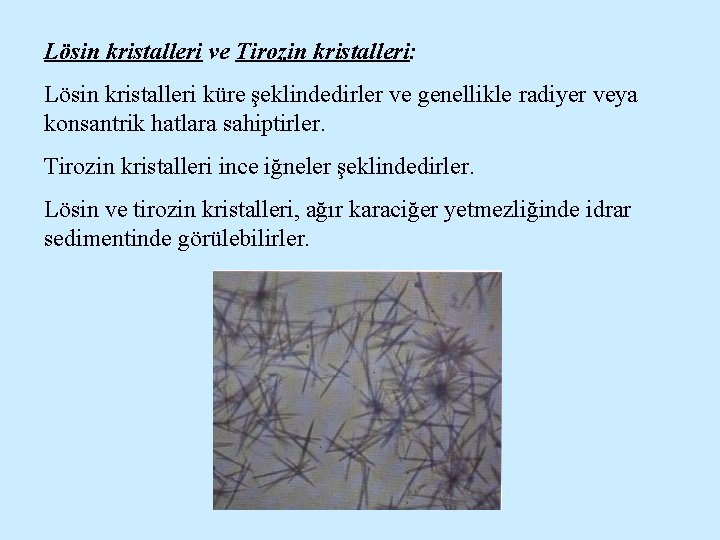 Lösin kristalleri ve Tirozin kristalleri: Lösin kristalleri küre şeklindedirler ve genellikle radiyer veya konsantrik