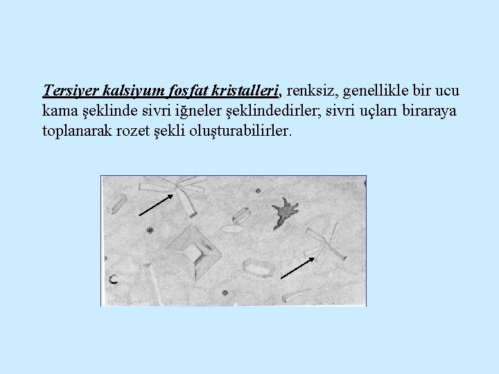 Tersiyer kalsiyum fosfat kristalleri, renksiz, genellikle bir ucu kama şeklinde sivri iğneler şeklindedirler; sivri