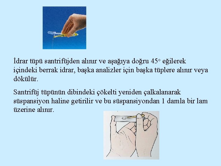 İdrar tüpü santrifüjden alınır ve aşağıya doğru 45 o eğilerek içindeki berrak idrar, başka
