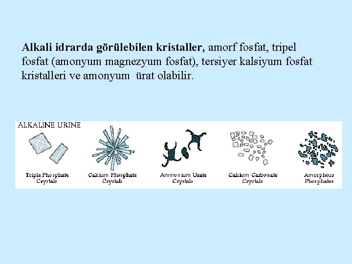 Alkali idrarda görülebilen kristaller, amorf fosfat, tripel fosfat (amonyum magnezyum fosfat), tersiyer kalsiyum fosfat