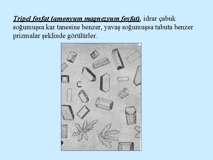 Tripel fosfat (amonyum magnezyum fosfat), idrar çabuk soğumuşsa kar tanesine benzer, yavaş soğumuşsa tabuta