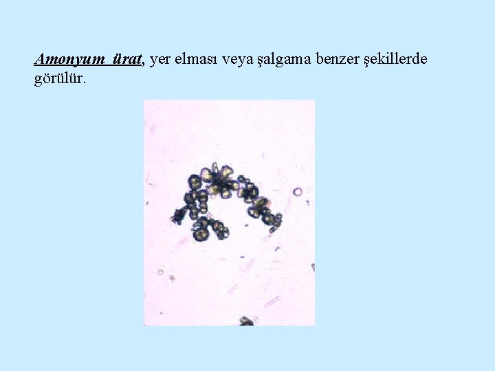 Amonyum ürat, yer elması veya şalgama benzer şekillerde görülür. 