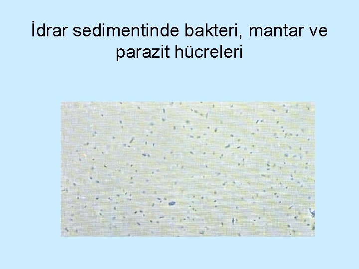 İdrar sedimentinde bakteri, mantar ve parazit hücreleri 