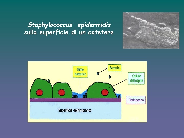 Staphylococcus epidermidis sulla superficie di un catetere 