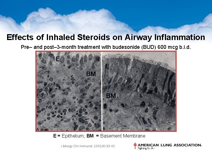 Effects of Inhaled Steroids on Airway Inflammation Pre– and post– 3 -month treatment with