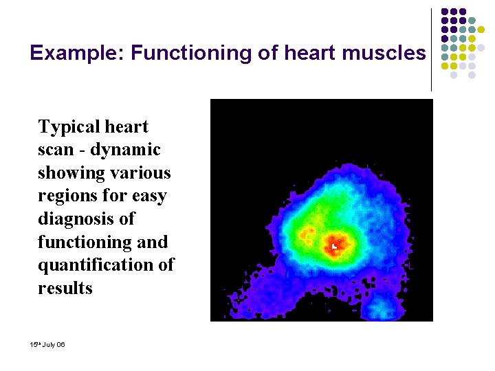 Example: Functioning of heart muscles Typical heart scan - dynamic showing various regions for