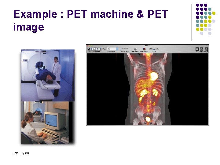 Example : PET machine & PET image 15 th July 06 