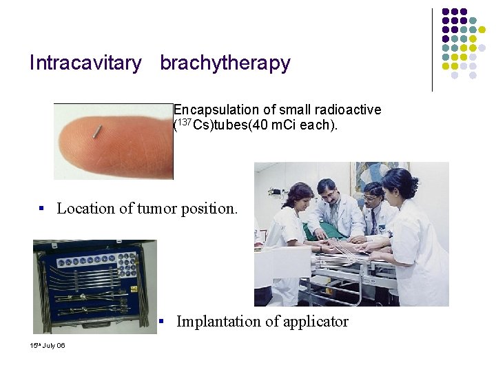 Intracavitary brachytherapy l Encapsulation of small radioactive (137 Cs)tubes(40 m. Ci each). § Location