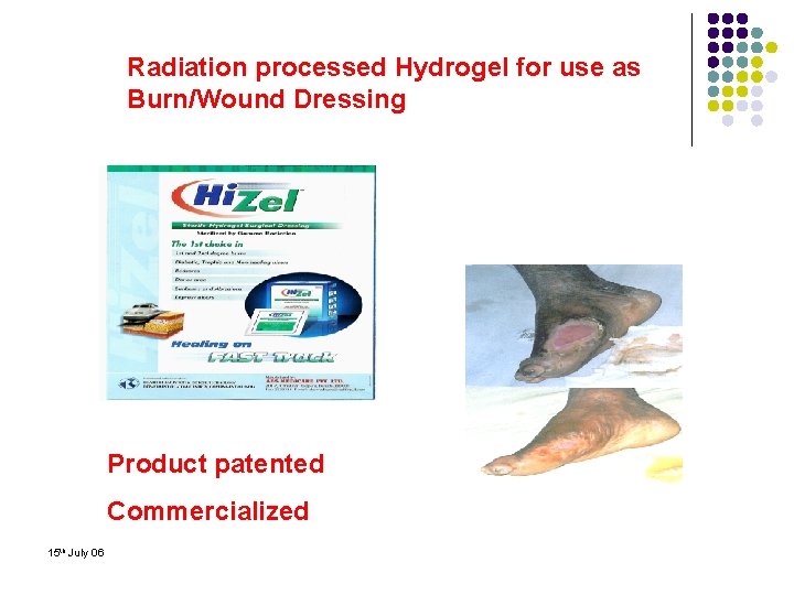 Radiation processed Hydrogel for use as Burn/Wound Dressing Product patented Commercialized 15 th July