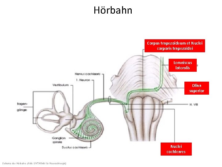 Hörbahn Corpus trapezoideum et Nuclei corporis trapezoidei Lemniscus lateralis Oliva superior Nuclei cochleares Schema