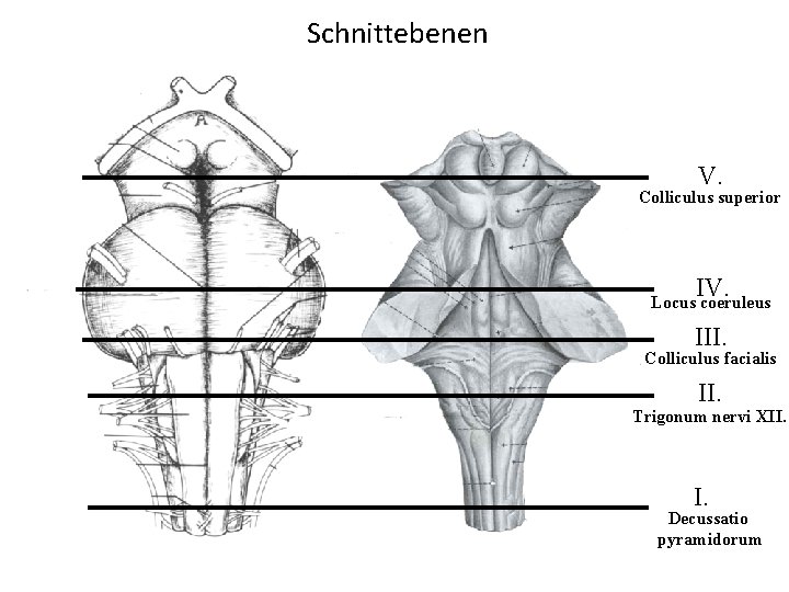 Schnittebenen V. Colliculus superior IV. Locus coeruleus III. Colliculus facialis II. Trigonum nervi XII.