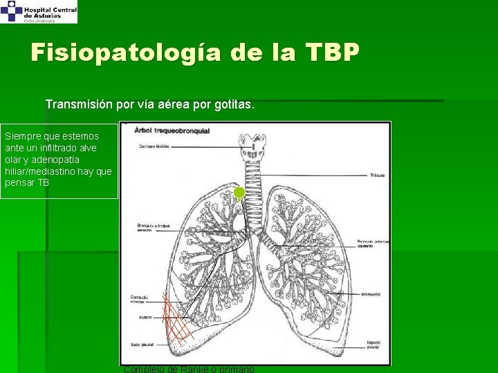 Fisiopatología de la TBP Transmisión por vía aérea por gotitas. Siempre que estemos ante