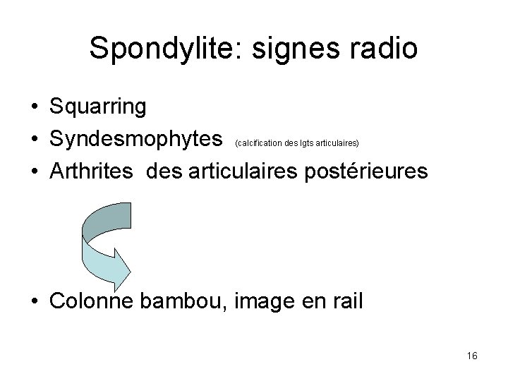 Spondylite: signes radio • Squarring • Syndesmophytes • Arthrites des articulaires postérieures (calcification des