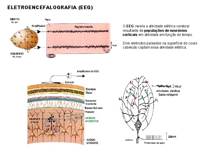 ELETROENCEFALOGRAFIA (EEG) O EEG revela a atividade elétrica cerebral resultante de populações de neurônios