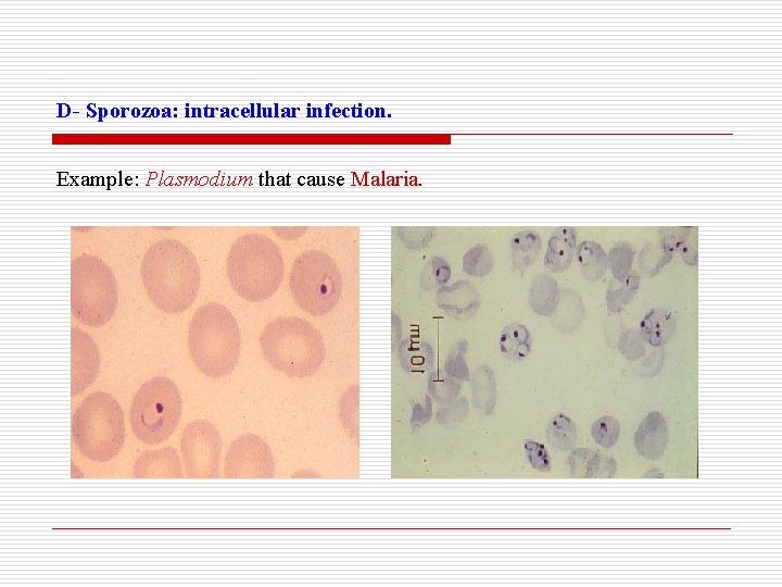 D- Sporozoa: intracellular infection. Example: Plasmodium that cause Malaria. 