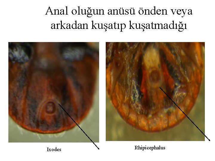 Anal oluğun anüsü önden veya arkadan kuşatıp kuşatmadığı Ixodes Rhipicephalus 