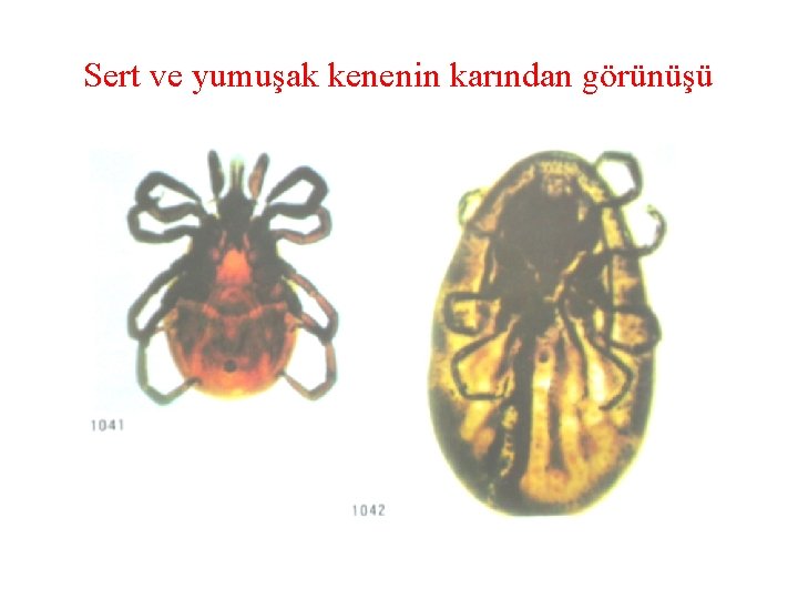 Sert ve yumuşak kenenin karından görünüşü 