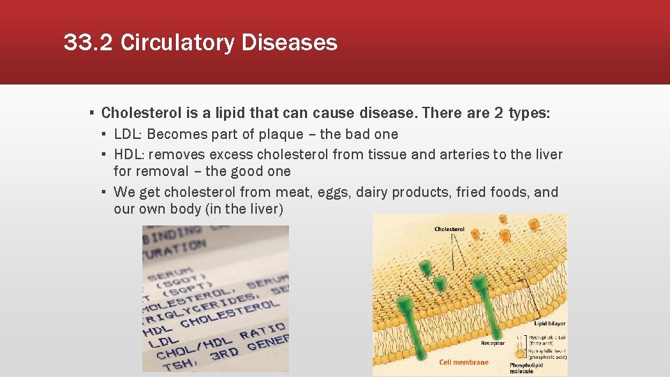 33. 2 Circulatory Diseases ▪ Cholesterol is a lipid that can cause disease. There