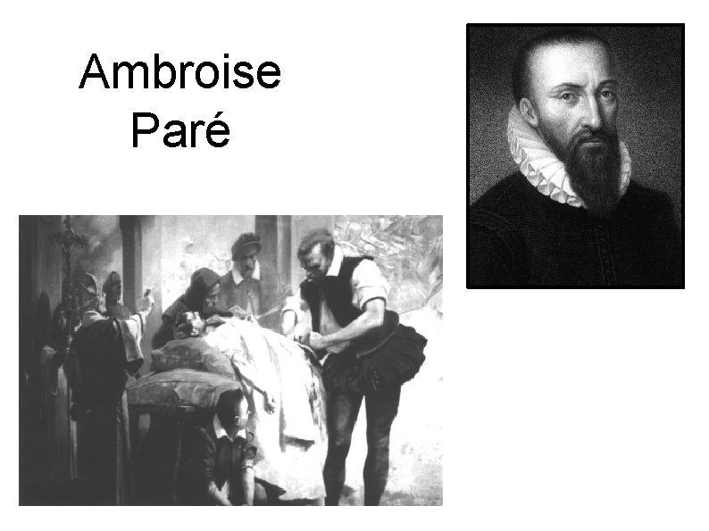 Ambroise Paré 