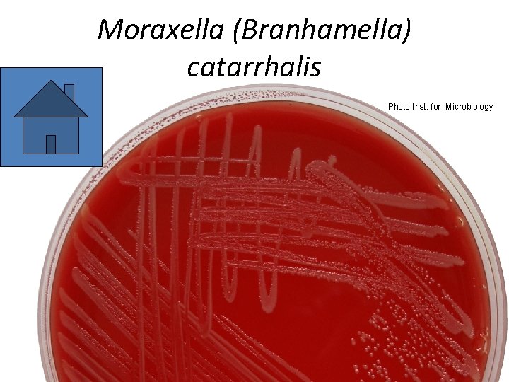 Moraxella (Branhamella) catarrhalis Photo Inst. for Microbiology 