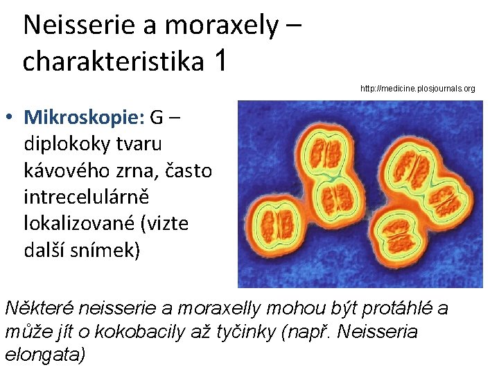 Neisserie a moraxely – charakteristika 1 http: //medicine. plosjournals. org • Mikroskopie: G –