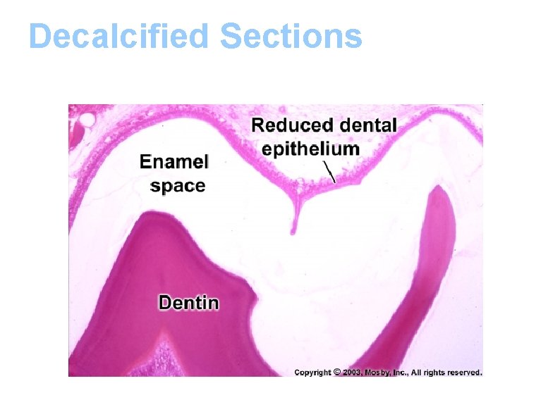 Decalcified Sections 