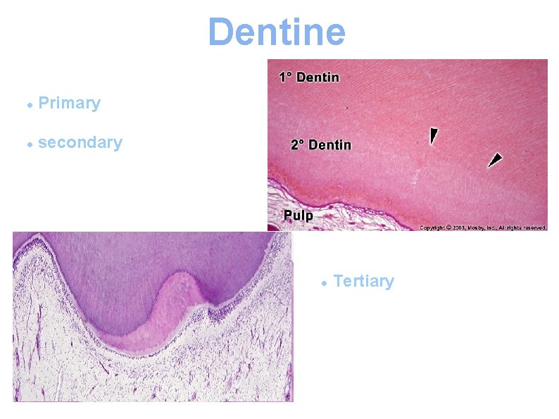 Dentine ● Primary dentine ● secondary dentine ● Tertiary dentine. 