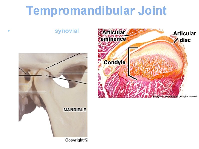 Tempromandibular Joint • The TMJ is the synovial articulation between the mandible and the