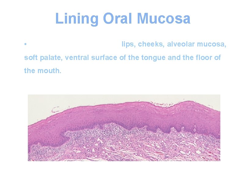 Lining Oral Mucosa • Lining mucosa covers the lips, cheeks, alveolar mucosa, soft palate,