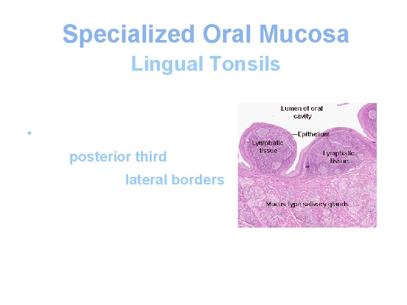 Specialized Oral Mucosa Lingual Tonsils • Lingual tonsils are situated at the posterior third