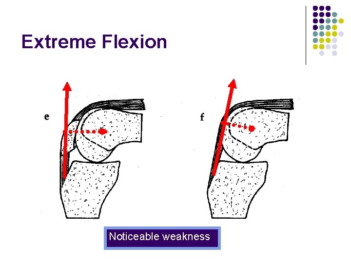 Extreme Flexion Noticeable weakness 