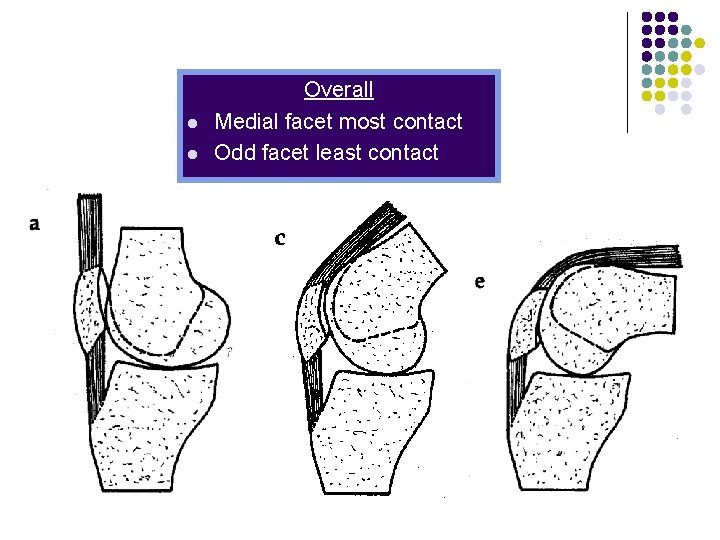 l l Overall Medial facet most contact Odd facet least contact 