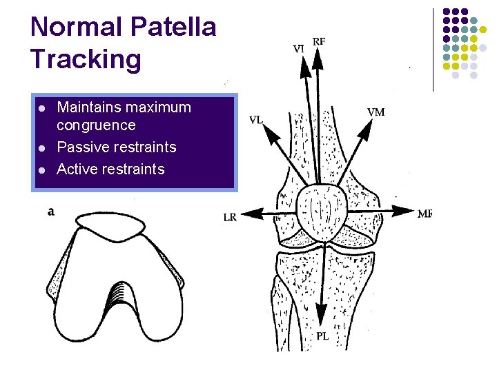 Normal Patella Tracking l l l Maintains maximum congruence Passive restraints Active restraints 