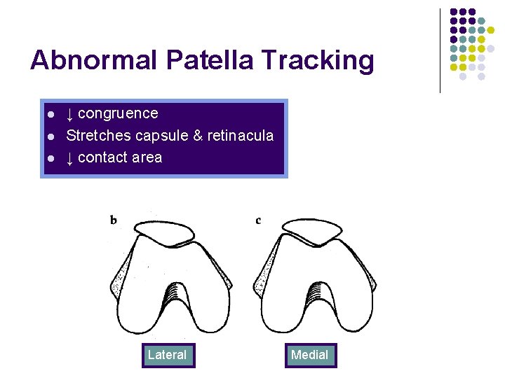 Abnormal Patella Tracking l l l ↓ congruence Stretches capsule & retinacula ↓ contact