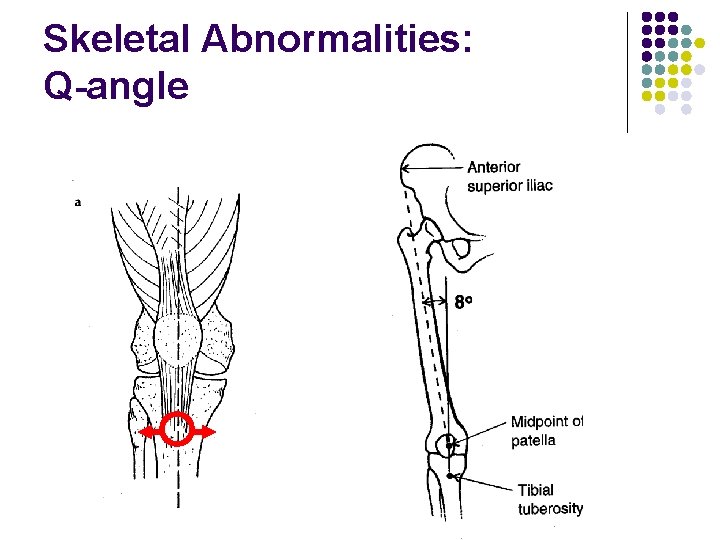 Skeletal Abnormalities: Q-angle 