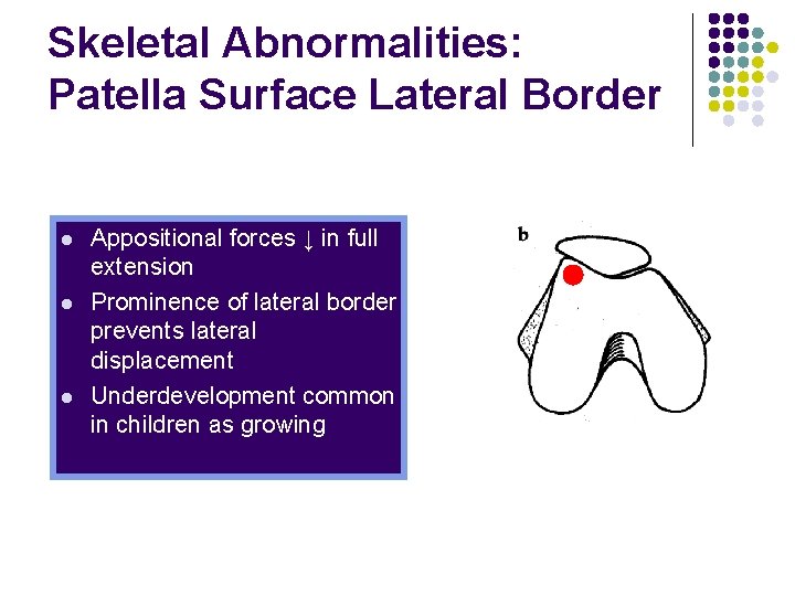 Skeletal Abnormalities: Patella Surface Lateral Border l l l Appositional forces ↓ in full