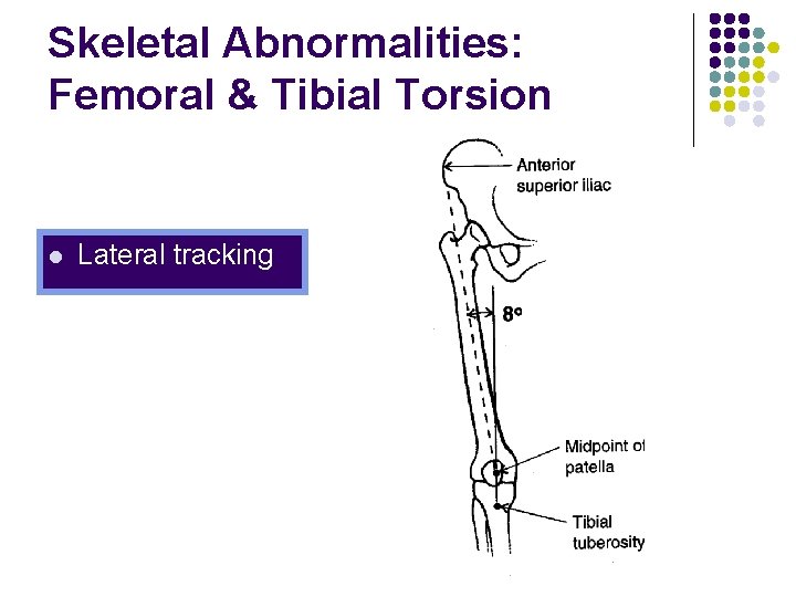 Skeletal Abnormalities: Femoral & Tibial Torsion l Lateral tracking 